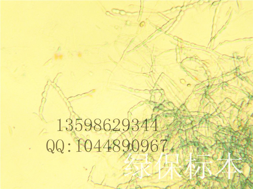 枯萎菌厚垣孢子