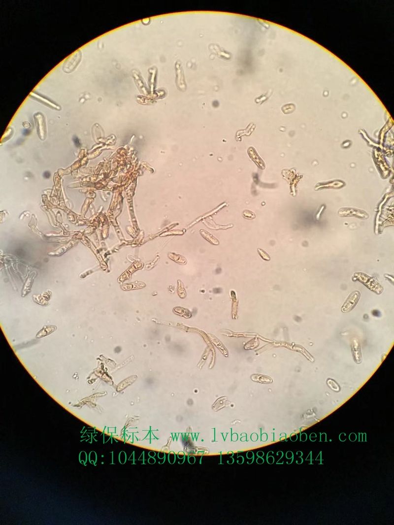 番茄叶霉病菌农业普通植物病理学植物保护学病害显微镜玻片切片装片标本