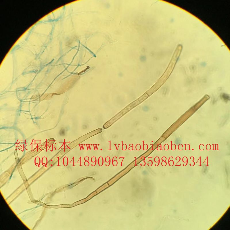 黄瓜褐斑病菌 植物病害病原玻片标本 蔬菜病害标本