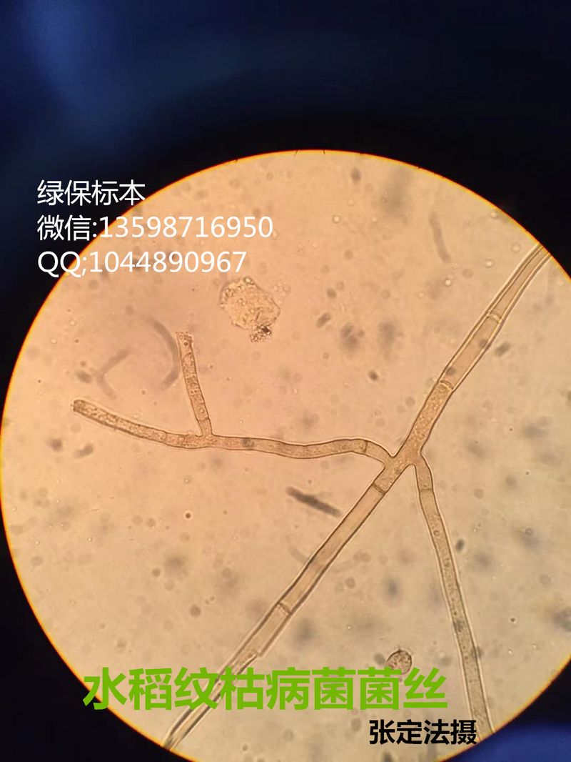 丝核菌属 水稻纹枯病菌菌丝玻片标本
