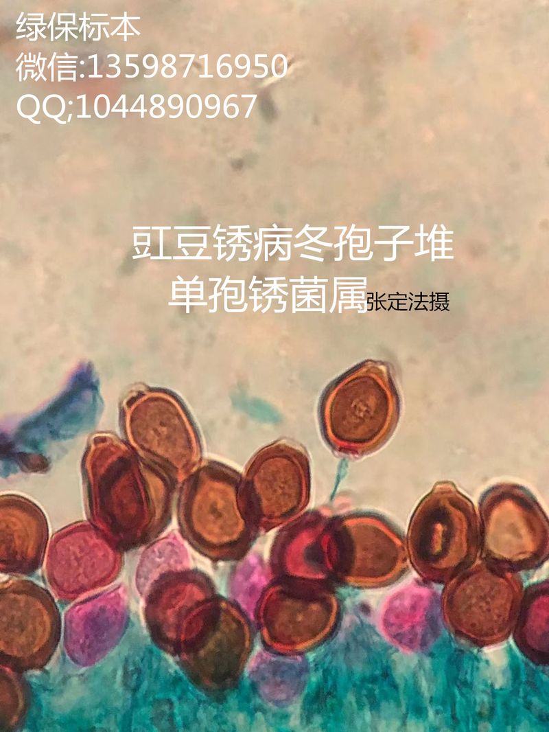 单孢锈菌属 豇豆锈病菌冬孢子堆切片标本