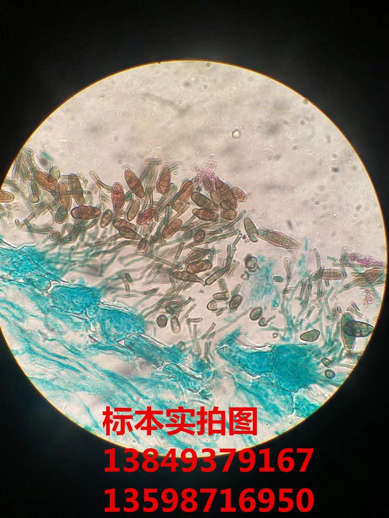 梨黑斑病菌 植物作物果树蔬菜病原物玻片标本
