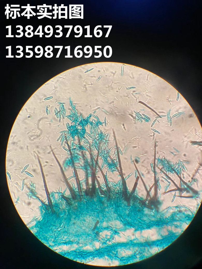 炭疽病菌 植物作物果树蔬菜病害显微镜玻片标本