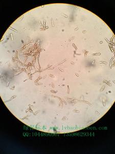 番茄叶霉病菌农业普通植物病理学植物保护学病害显微镜玻片切片装片标本