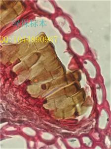 小麦叶锈病菌切片 植物病害虫害标本