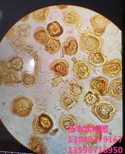 谷子白发病卵孢子植物作物果树蔬菜病虫害玻片标本