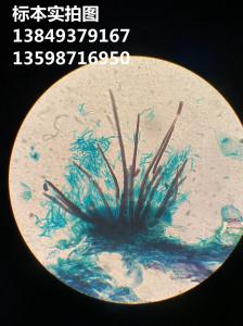 辣椒炭疽病菌植物作物果树蔬菜病虫害显微镜玻片标本