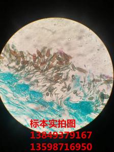 梨黑斑病菌 植物作物果树蔬菜病原物玻片标本