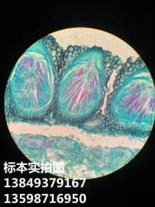 小麦赤霉病菌植物病害病菌显微玻片标本