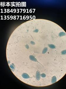 疫霉病菌 植物作物果树蔬菜病菌显微镜玻片标本