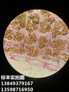 玉米褐斑病菌植物作物果树蔬菜病害显微镜玻片标本