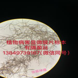 有隔菌丝  植物病理显微玻片标本
